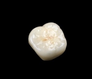 porcelain crowns